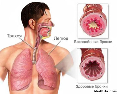 Органы дыхания